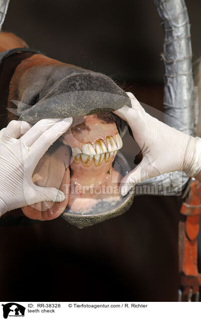 Zahnkontrolle / teeth check / RR-38328