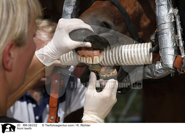 Frontzhne abschleifen / front teeth / RR-38332