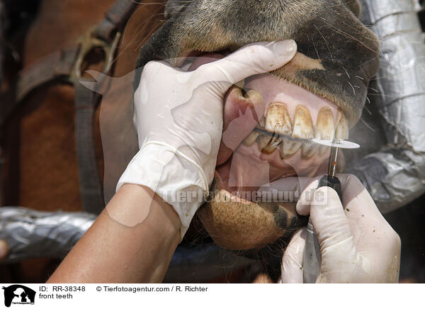 front teeth / RR-38348