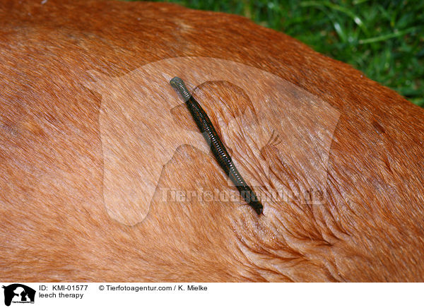Blutegeltherapie / leech therapy / KMI-01577