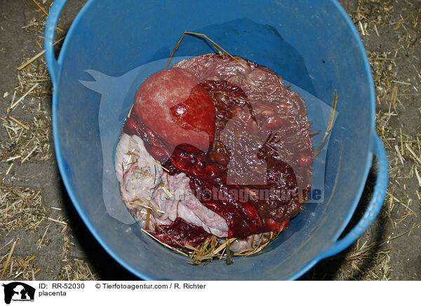 Nachgeburt / placenta / RR-52030